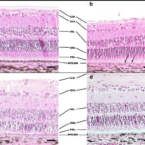 Light Micrographs Hematoxylin And Eosin Stain A Normal Retina B T 0
