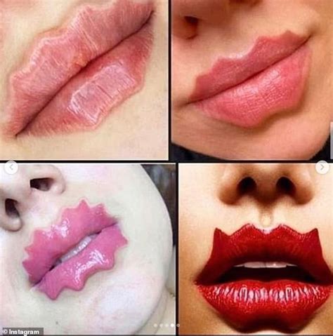 Bizarre New Beauty Trend Sees Women Use Lip Fillers And Makeup To