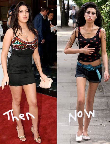 Amy Winehouse Before And After Drugs Ims85