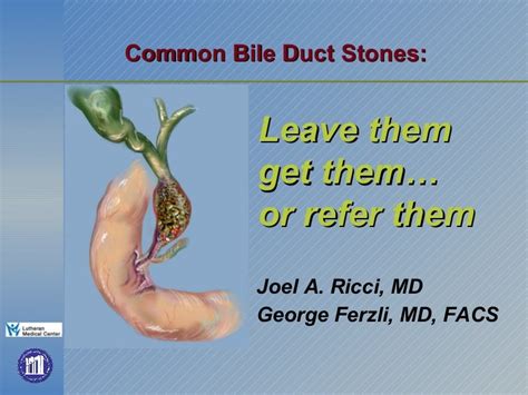 Common Bile Duct Stones Leave Them Get Them Or Refer Them