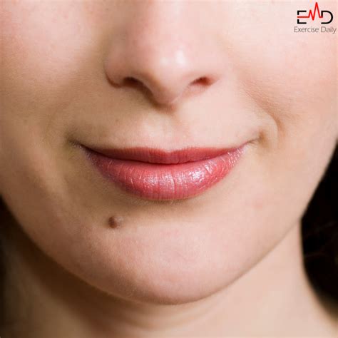 White Bumps On Lips Causes And Management