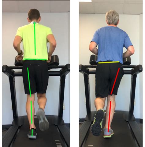 Running Dynamic Knee Valgus — Precision Physical Therapy