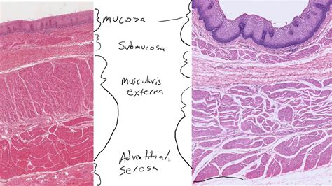 Hsci Histology Histology Of The Alimentary Canal Wall Youtube