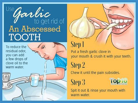 Tooth Abscess 10 Home Remedies To Help Manage The Infection With
