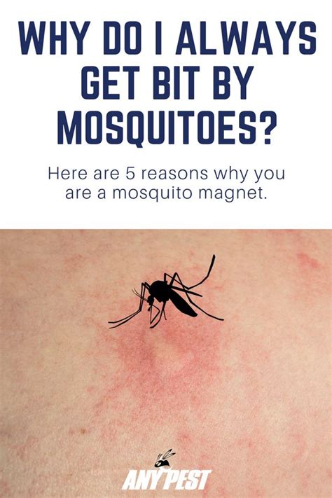 10 Easy Ways To Stop Mosquito Bites From Itching Blog Mosquito Bite