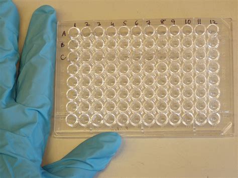 Sõpruse pst 145, 13425 tallinn. ELISA (test immunoenzymatyczny) - Wikipedia, wolna ...