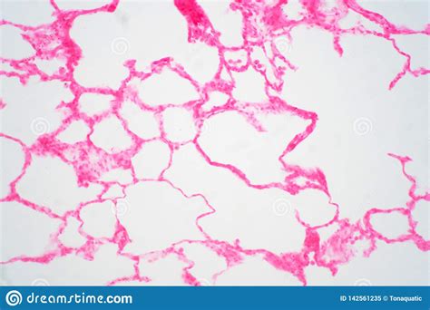 Human Lung Tissue Under Microscope View Stock Image Image Of Breathe