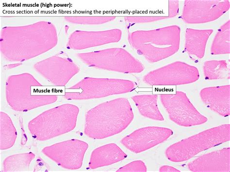 Skeletal Muscle Normal Histology Nus Pathweb Nus Pathweb