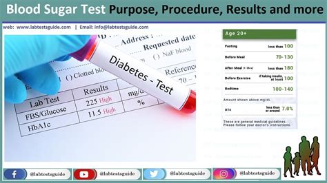 Blood Glucose Random Test Purpose Procedure Result And More Lab