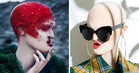 Melanie Gaydos Model With Rare Genetic Disorder Who Shows The World That Beauty Can Be
