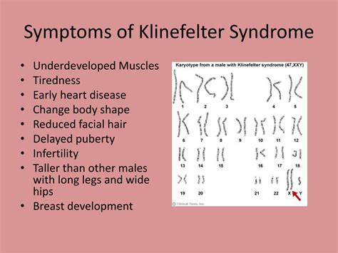 ppt klinefelter syndrome powerpoint presentation free download id 3085615