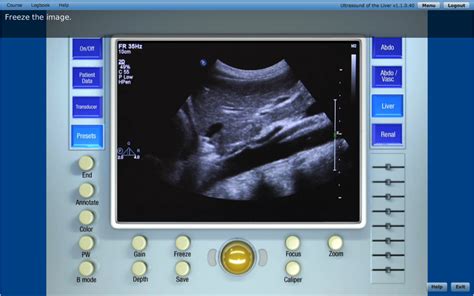 Sonography And Ultrasound Technology Programs