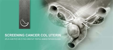 Col Uterin 2 Clinica Pro Vita