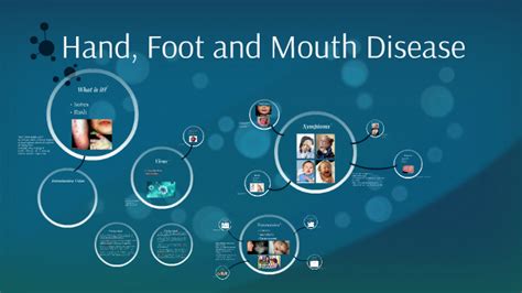 Hand Foot Mouth Disease By Delaney Johnston