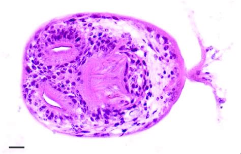Photomicrograph Of A Section Through A Protoscolex Obtained From An E