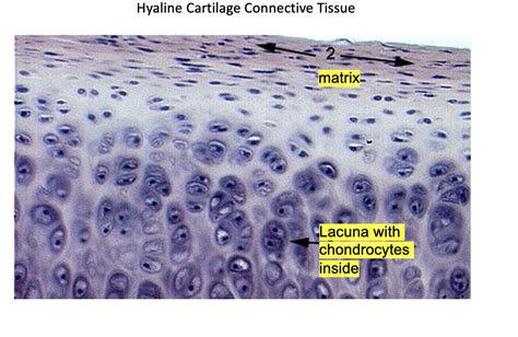 Solved Hyaline Cartilage Connective Tissue Matrix Lacuna