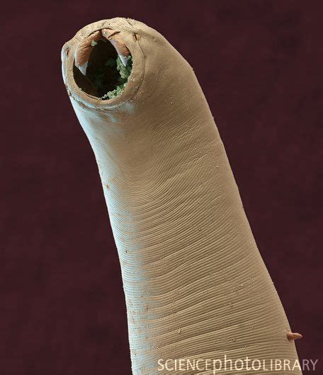 Hookworm Coloured Scanning Electron Micrograph Sem Of The Head Of