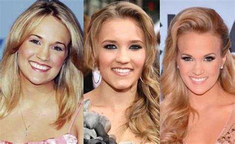 Did Carrie Underwood Have Plastic Surgery For Her Lips Before And