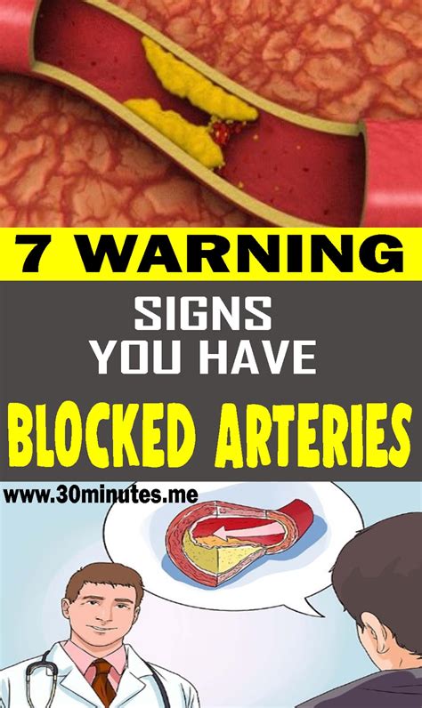 Here Are 7 Warning Signs You Have Blocked Arteries