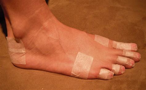 How To Avoid Blisters Under Toenail From Running 8 Simple Tips