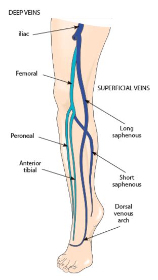 Superficial Can Also Be Deep Superficial Thrombophlebitis