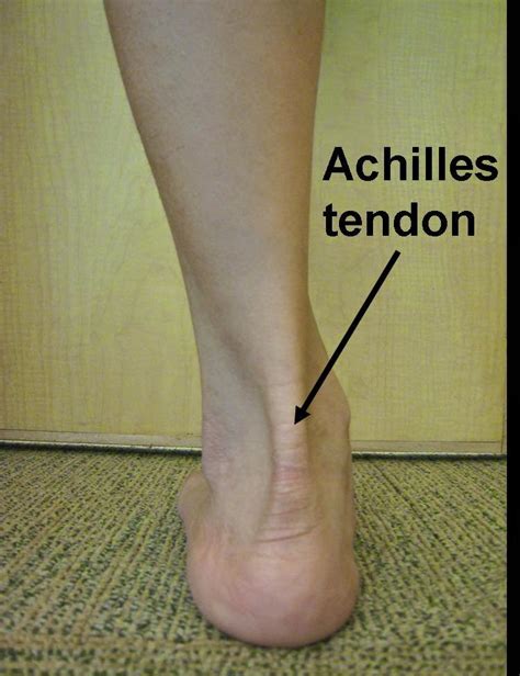 Myo Therapy And Healthcare Institute Achilles Tendinopathy
