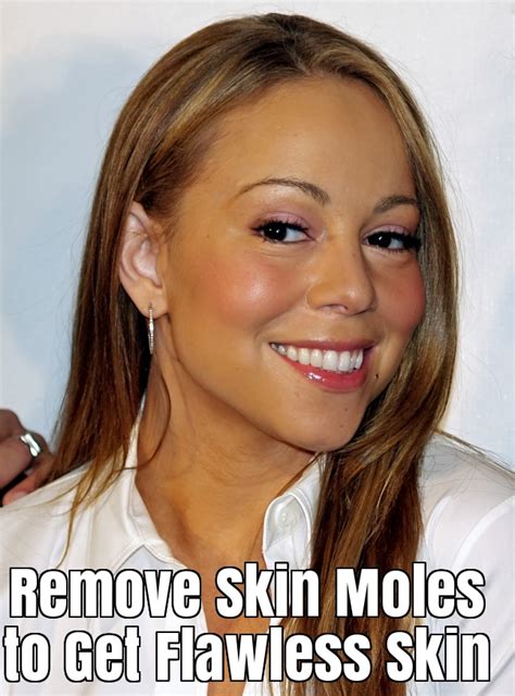 Oct 29, 2018 · there are a few common procedures for removing red moles. How to Get Rid of Moles On Skin? Home Remedies for Moles