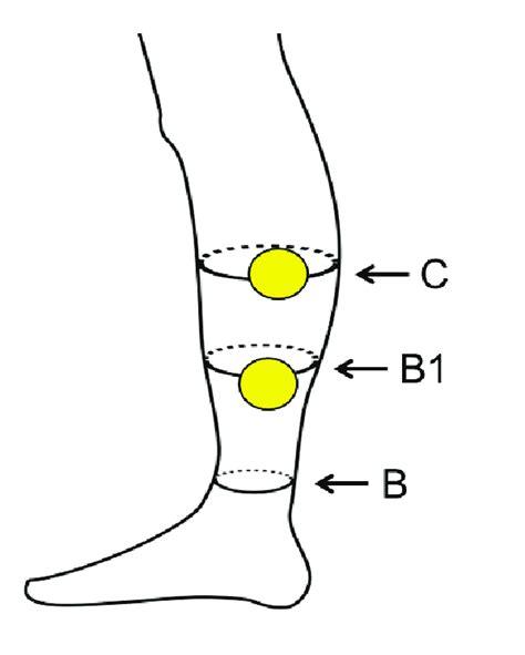 Learn its anatomy and achilles tendon: 1: Location of measurement points B1 (where the Achilles ...