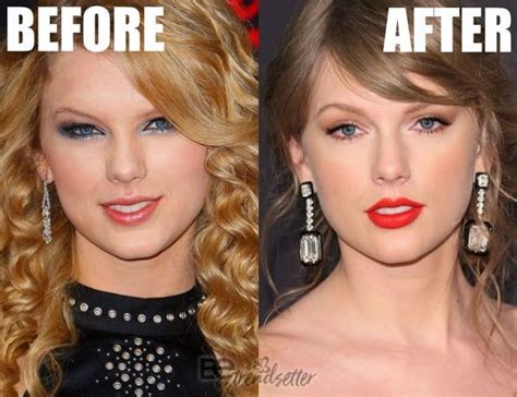 Taylor Swift Plastic Surgery The Before And After Photos Of Her Tell That She Had Surgery For