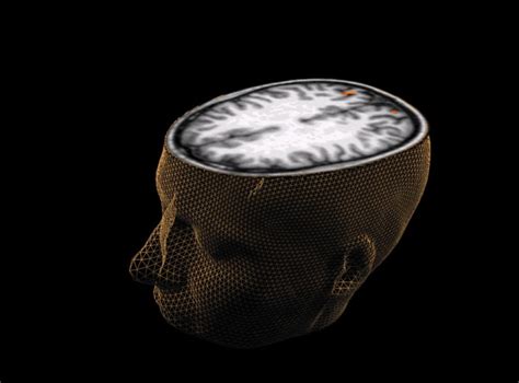 Brain Scans Could Predict Criminal Behavioural Patterns Claims