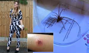 Carelle Mowatt Bitten By Brown Recluse Spider Leaving A Hole In Her Leg