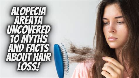 Alopecia Areata Uncovered Myths And Facts About Hair Loss Youtube