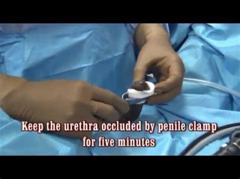 Cystoscopy How To Anaesthetize The Urethra