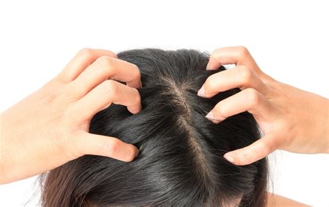 Oily Scalps Do They Cause Hair Loss 2021 Hair Loss Geeks