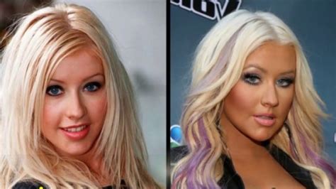 20 Celebrity Before And After Plastic Surgery Disasters Funtality