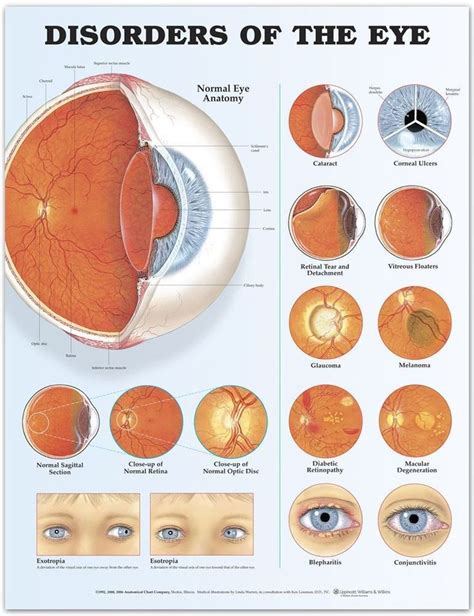 Disorders Of The Eye Laminated Anatomical Chart 2nd Edition Eye