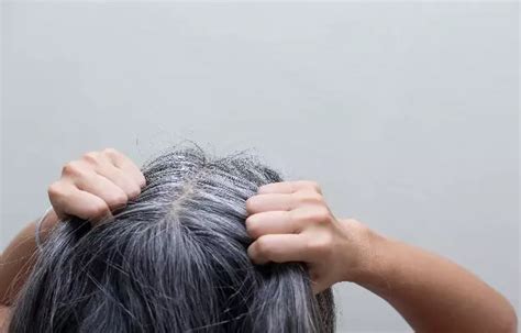 Does Stress Cause Grey Hair