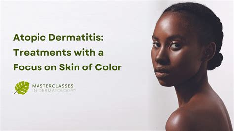 Atopic Dermatitis Treatments With A Focus On Skin Of Color