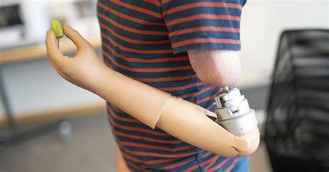 The Future Of Prosthetics Might Be In This Mind Controlled Bionic Arm