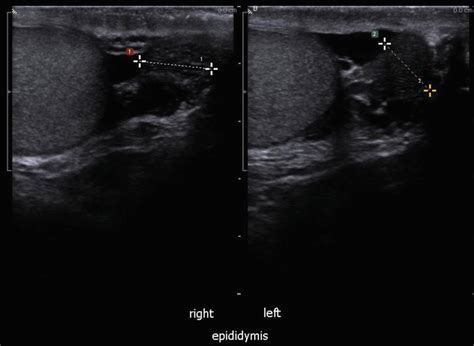 urologic ultrasound protocols radiology key