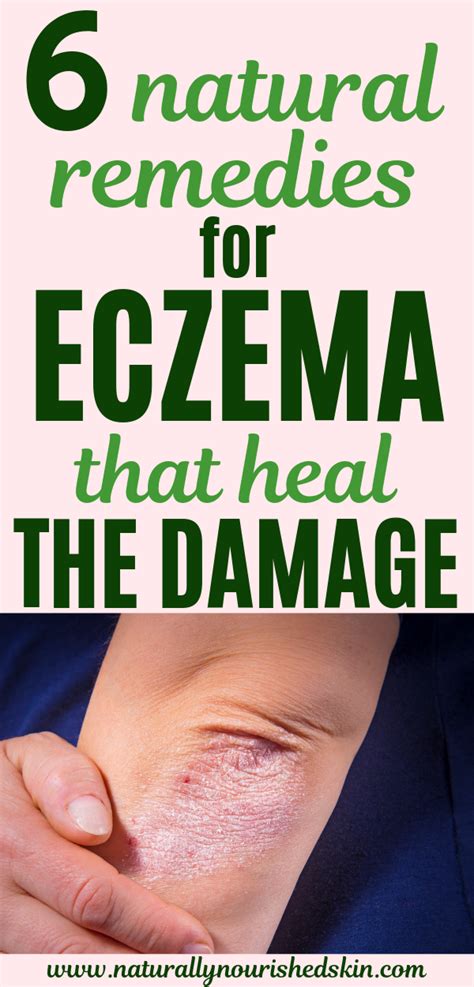 6 Natural Remedies For Eczema That Heal The Damage Eczema Remedies