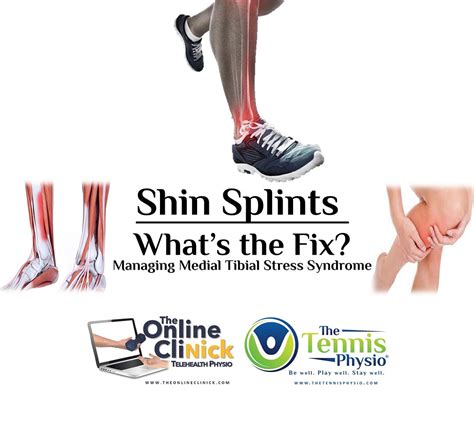 Shin Splints — Whats The Fix Managing Medial Tibial Stress Syndrome