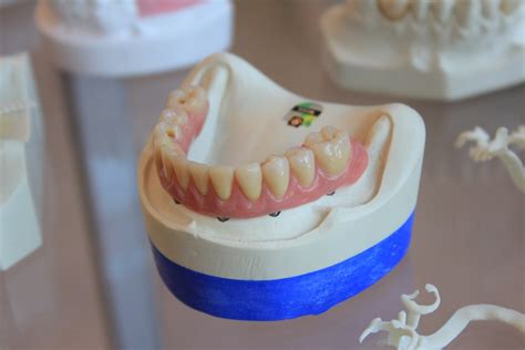 4 Easy Ways To Remove Denture Adhesive European Denture