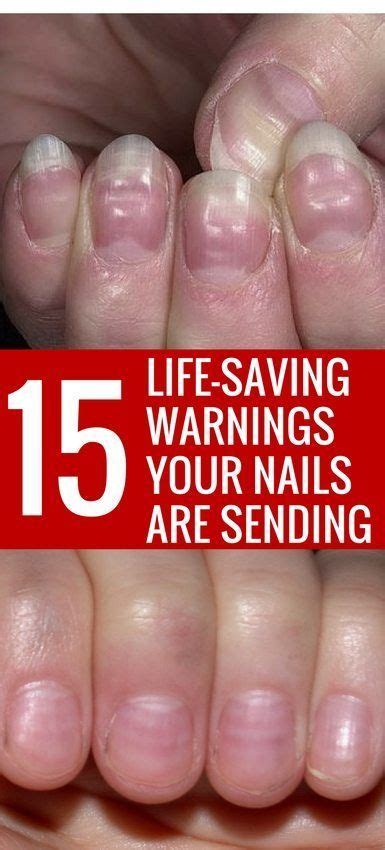 15 Health Warnings Your Fingernails Are Sending Nail Health Signs