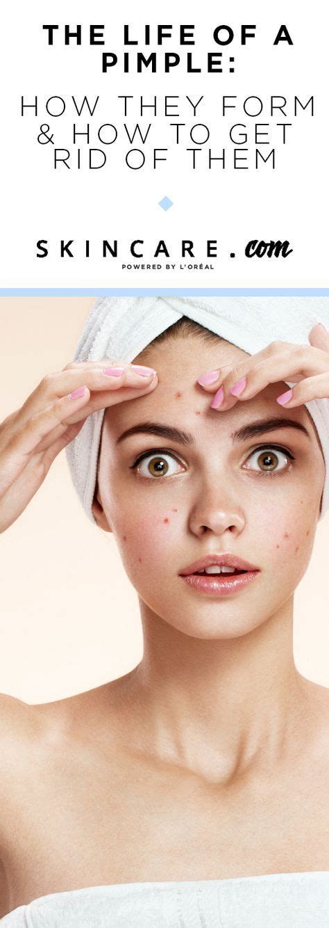 Pimples Breakouts Blemishes Acne— Whatever You Call Them Theyre