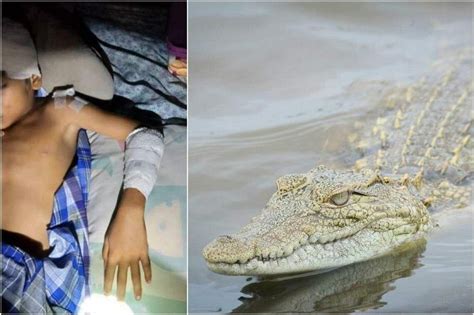 صبي يبلغ من العمر 9 سنوات في ماليزيا يقاوم التمساح الذي هاجمه وهو يسبح