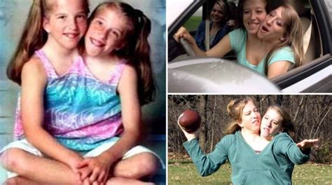 Conjoined Twin Sisters Abby And Brittany Hensel Where Are They Now All Your Viral News