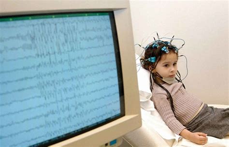 Benign Rolandic Epilepsy Causes Symptoms Diagnosis Treatment And Prognosis