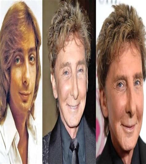 60 worst cases of celebrity plastic surgery gone wrong 8e9