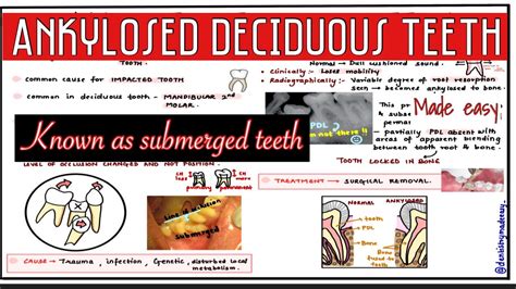 Ankylosed Deciduous Teeth Submerged Teeth Oral Pathology Youtube